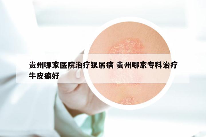 贵州哪家医院治疗银屑病 贵州哪家专科治疗牛皮癣好