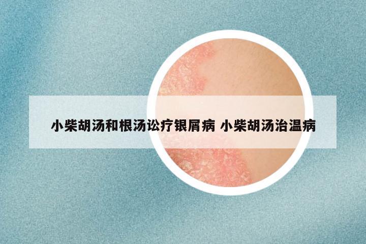 小柴胡汤和根汤讼疗银屑病 小柴胡汤治温病
