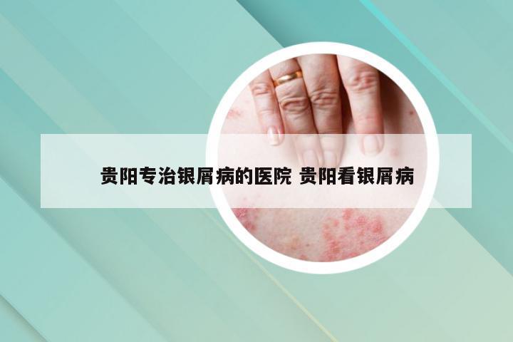贵阳专治银屑病的医院 贵阳看银屑病