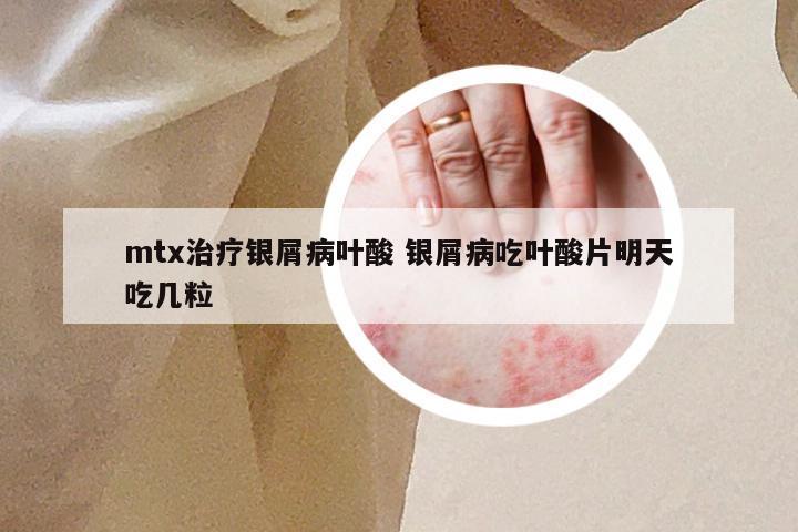 mtx治疗银屑病叶酸 银屑病吃叶酸片明天吃几粒