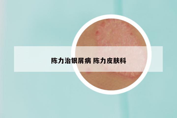 陈力治银屑病 陈力皮肤科