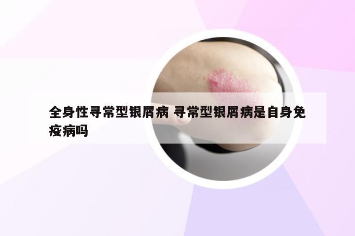 全身性寻常型银屑病 寻常型银屑病是自身免疫病吗