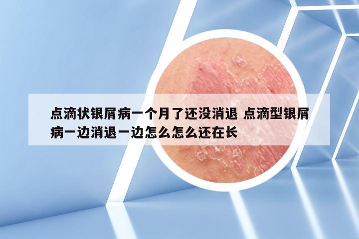 点滴状银屑病一个月了还没消退 点滴型银屑病一边消退一边怎么怎么还在长