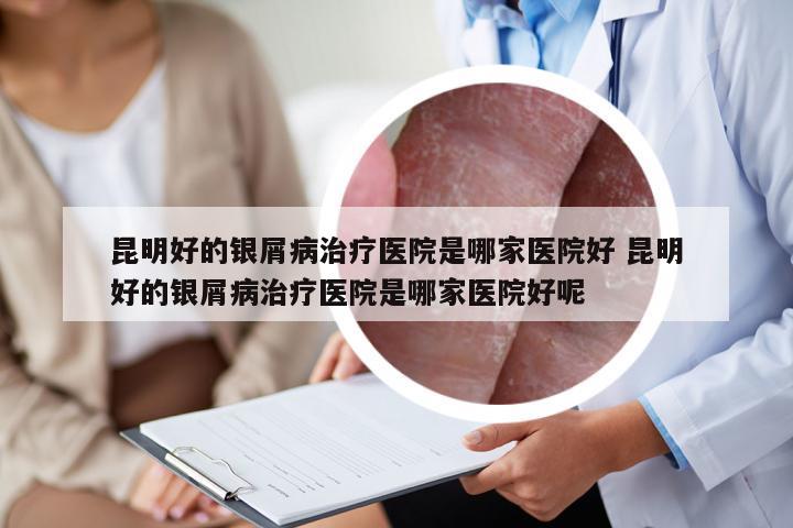昆明好的银屑病治疗医院是哪家医院好 昆明好的银屑病治疗医院是哪家医院好呢