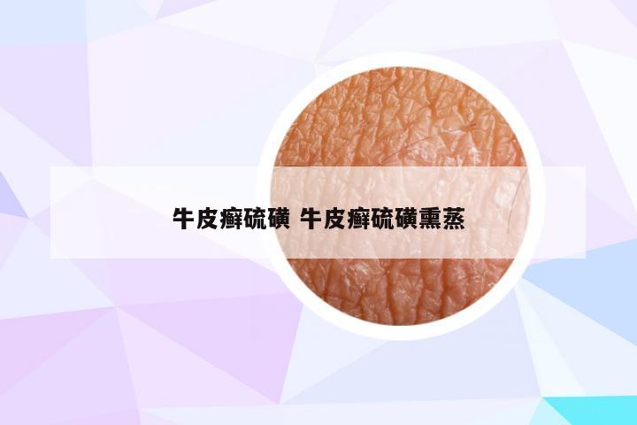 牛皮癣硫磺 牛皮癣硫磺熏蒸