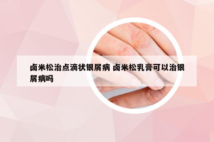 卤米松治点滴状银屑病 卤米松乳膏可以治银屑病吗