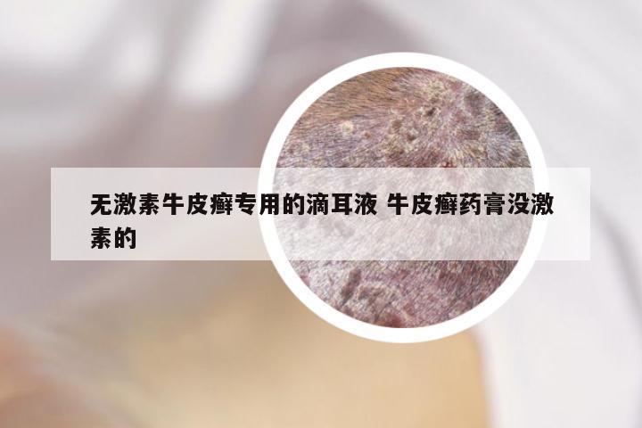 无激素牛皮癣专用的滴耳液 牛皮癣药膏没激素的