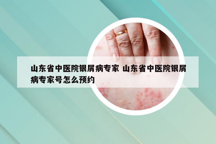 山东省中医院银屑病专家 山东省中医院银屑病专家号怎么预约
