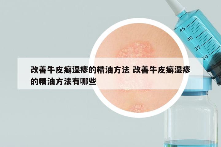 改善牛皮癣湿疹的精油方法 改善牛皮癣湿疹的精油方法有哪些