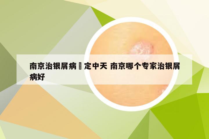 南京治银屑病約定中天 南京哪个专家治银屑病好
