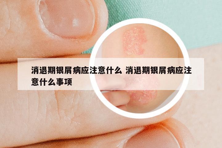 消退期银屑病应注意什么 消退期银屑病应注意什么事项