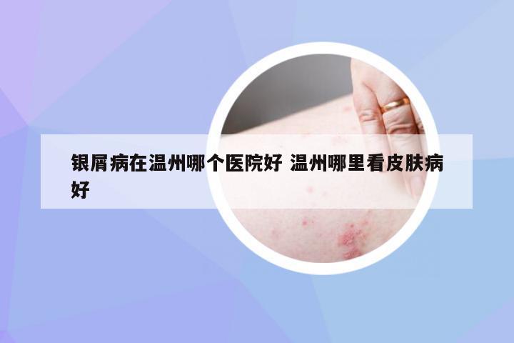 银屑病在温州哪个医院好 温州哪里看皮肤病好