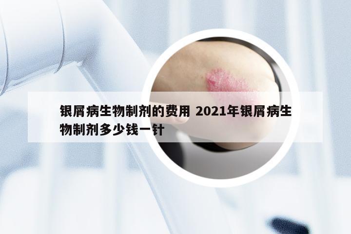 银屑病生物制剂的费用 2021年银屑病生物制剂多少钱一针