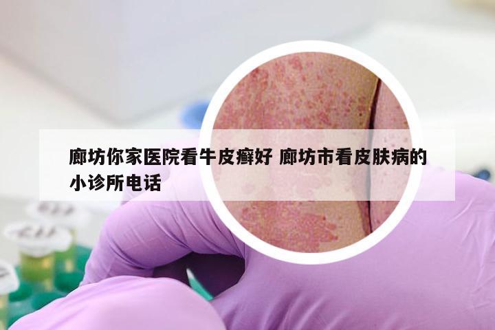 廊坊你家医院看牛皮癣好 廊坊市看皮肤病的小诊所电话