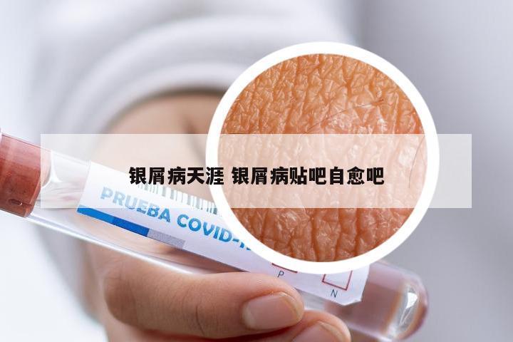 银屑病天涯 银屑病贴吧自愈吧