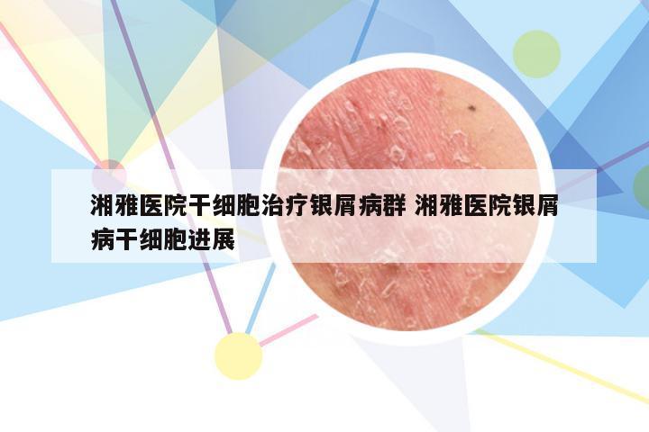 湘雅医院干细胞治疗银屑病群 湘雅医院银屑病干细胞进展