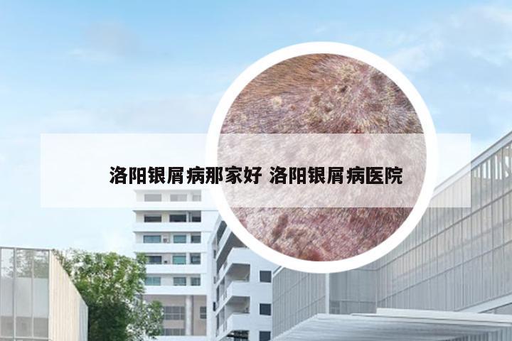 洛阳银屑病那家好 洛阳银屑病医院