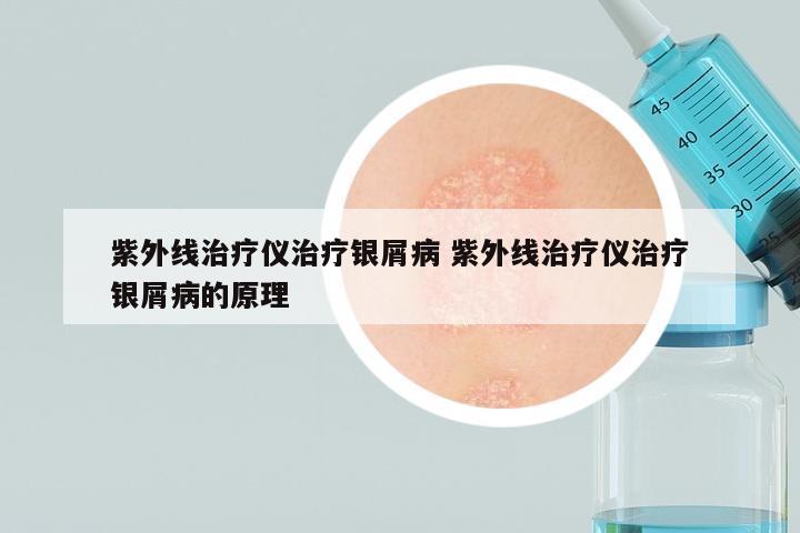 紫外线治疗仪治疗银屑病 紫外线治疗仪治疗银屑病的原理