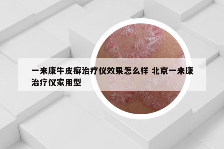 一来康牛皮癣治疗仪效果怎么样 北京一来康治疗仪家用型