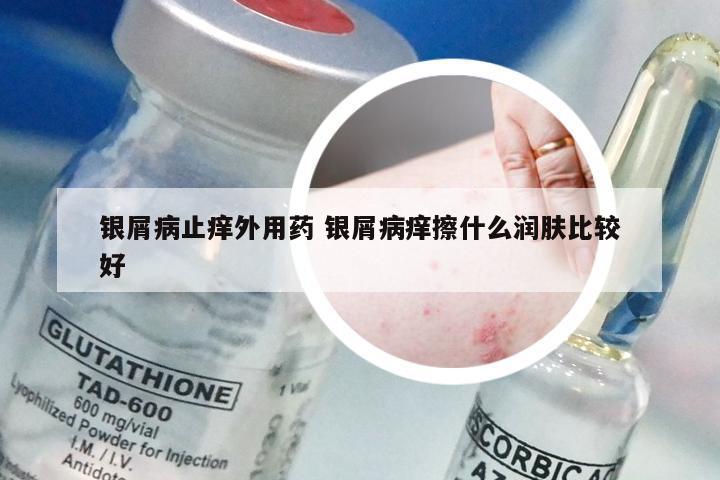 银屑病止痒外用药 银屑病痒擦什么润肤比较好