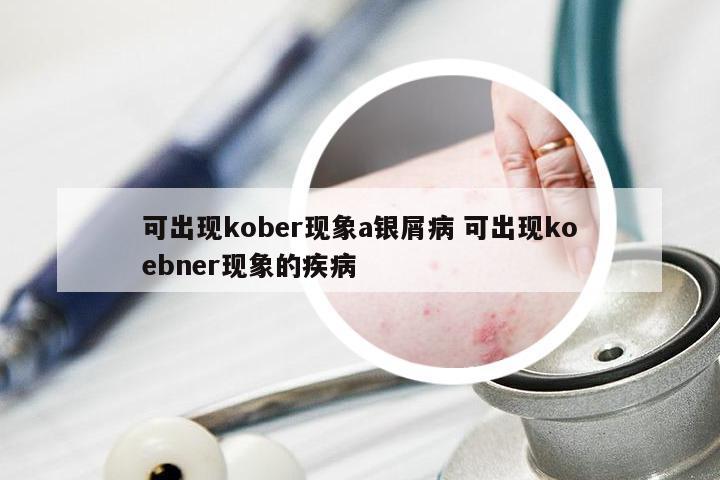 可出现kober现象a银屑病 可出现koebner现象的疾病