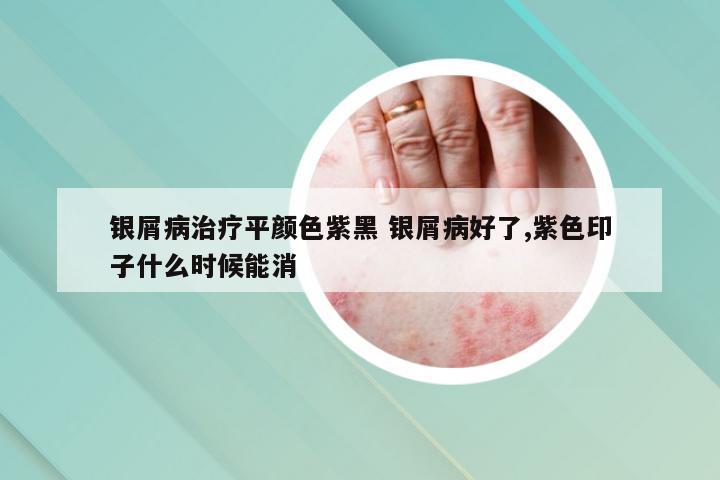 银屑病治疗平颜色紫黑 银屑病好了,紫色印子什么时候能消