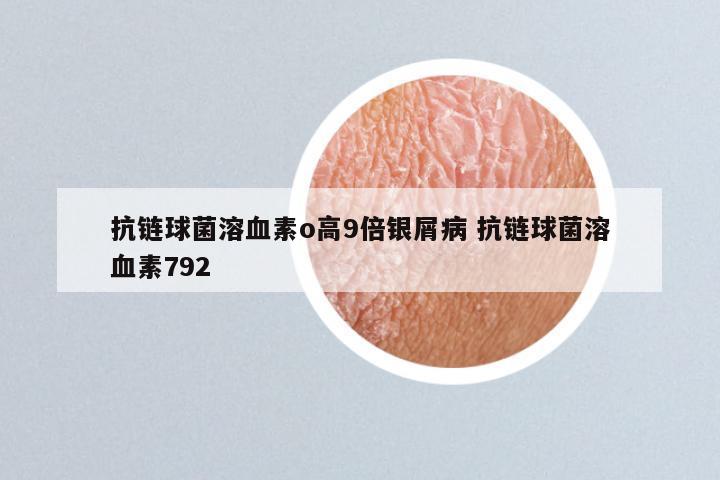 抗链球菌溶血素o高9倍银屑病 抗链球菌溶血素792