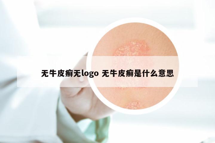 无牛皮癣无logo 无牛皮癣是什么意思