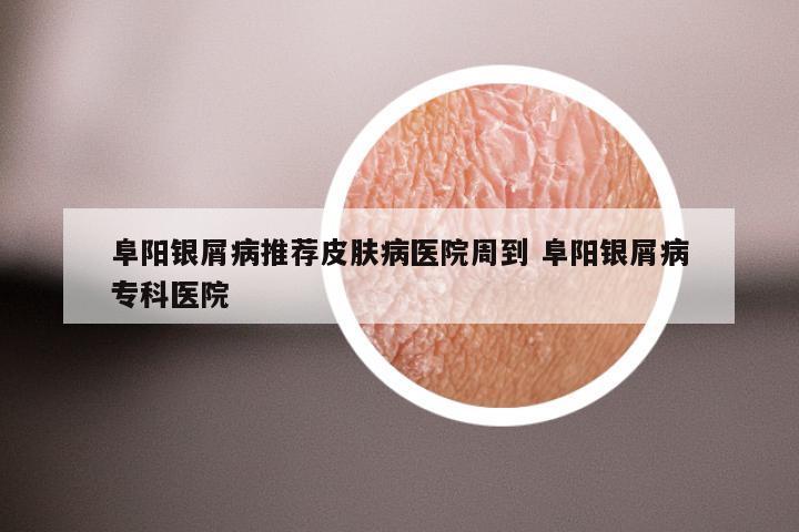 阜阳银屑病推荐皮肤病医院周到 阜阳银屑病专科医院