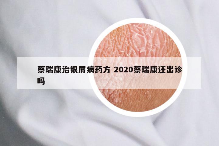 蔡瑞康治银屑病药方 2020蔡瑞康还出诊吗