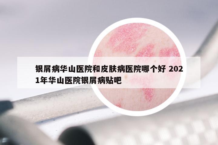 银屑病华山医院和皮肤病医院哪个好 2021年华山医院银屑病贴吧