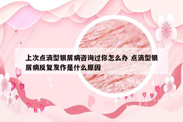 上次点滴型银屑病咨询过你怎么办 点滴型银屑病反复发作是什么原因