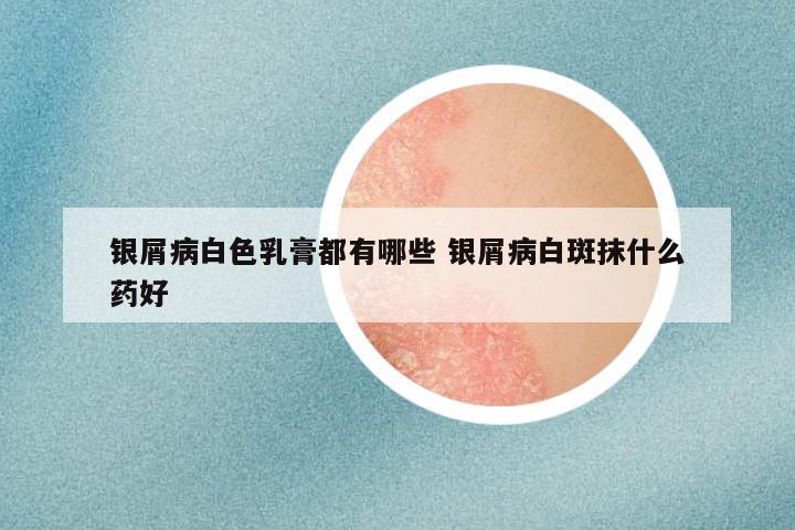 银屑病白色乳膏都有哪些 银屑病白斑抹什么药好