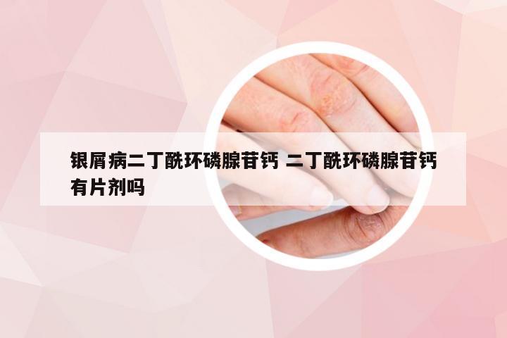 银屑病二丁酰环磷腺苷钙 二丁酰环磷腺苷钙有片剂吗