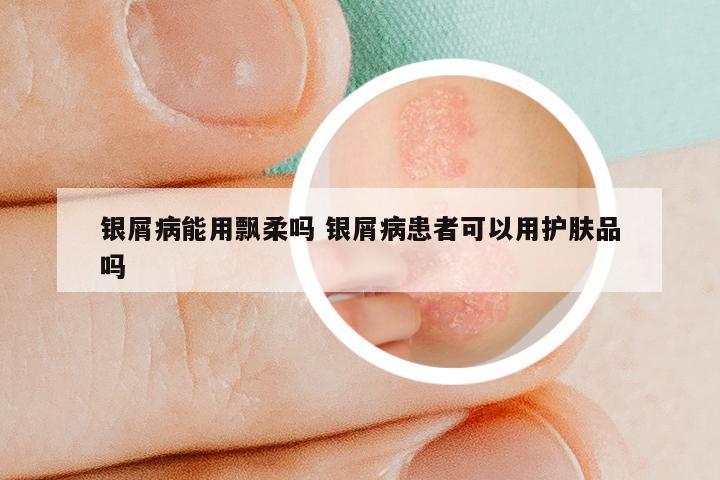 银屑病能用飘柔吗 银屑病患者可以用护肤品吗