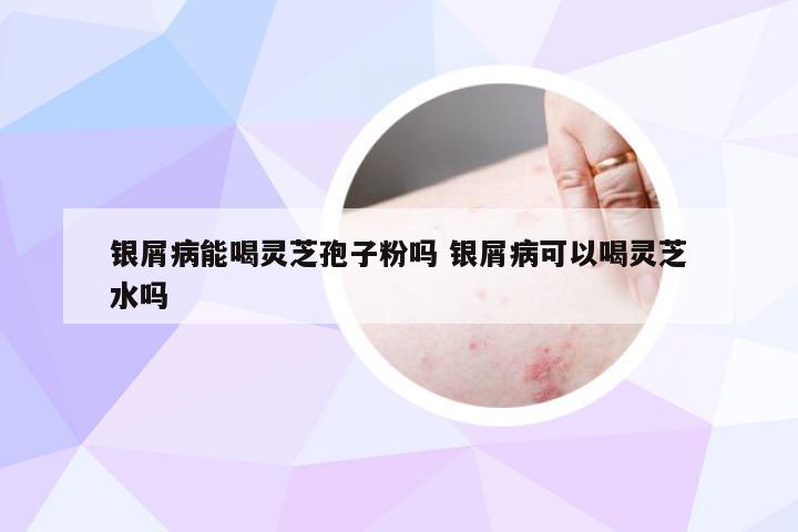 银屑病能喝灵芝孢子粉吗 银屑病可以喝灵芝水吗
