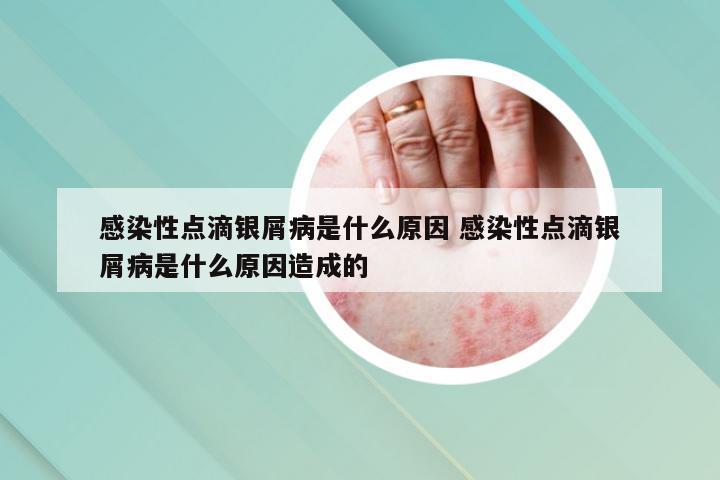 感染性点滴银屑病是什么原因 感染性点滴银屑病是什么原因造成的