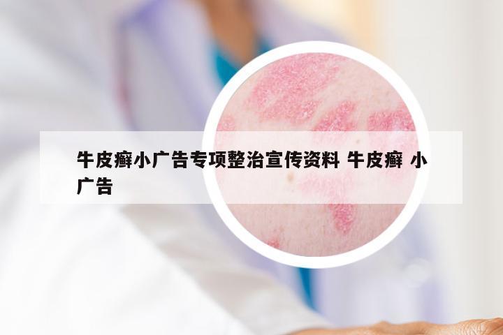 牛皮癣小广告专项整治宣传资料 牛皮癣 小广告