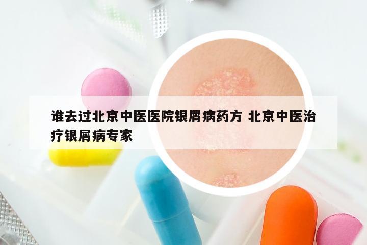 谁去过北京中医医院银屑病药方 北京中医治疗银屑病专家