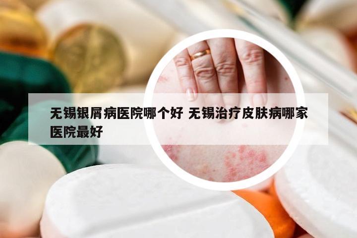 无锡银屑病医院哪个好 无锡治疗皮肤病哪家医院最好