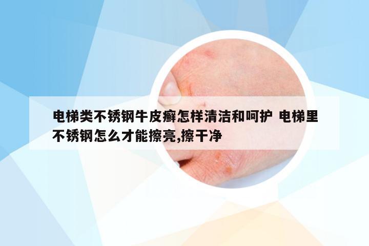 电梯类不锈钢牛皮癣怎样清洁和呵护 电梯里不锈钢怎么才能擦亮,擦干净