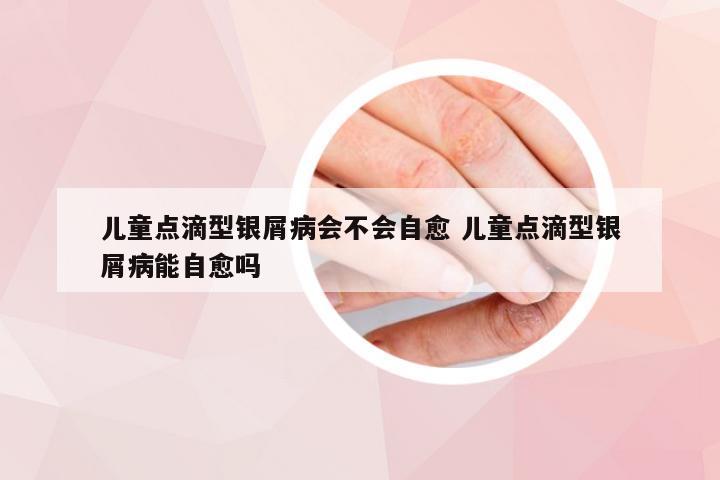 儿童点滴型银屑病会不会自愈 儿童点滴型银屑病能自愈吗