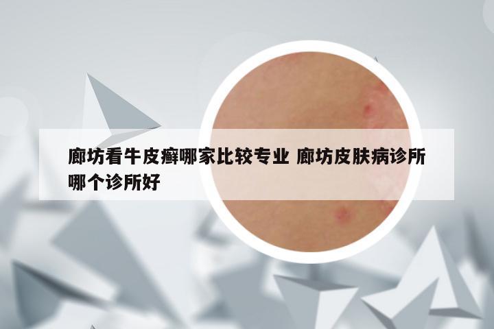 廊坊看牛皮癣哪家比较专业 廊坊皮肤病诊所哪个诊所好