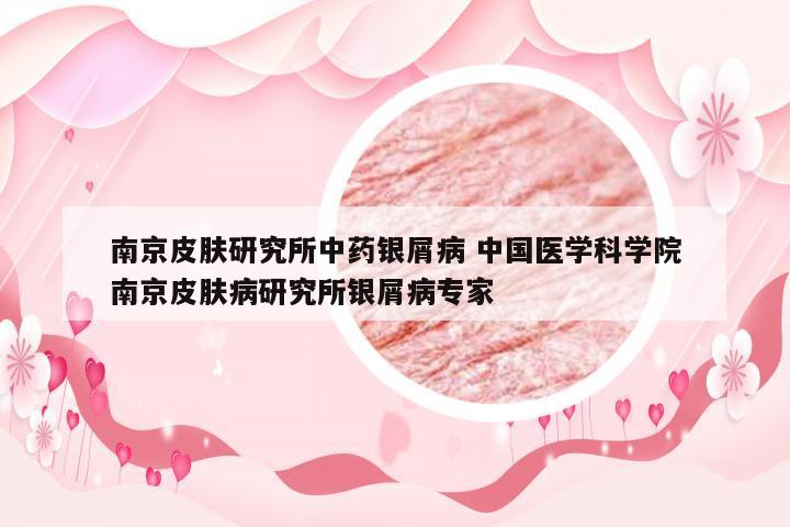 南京皮肤研究所中药银屑病 中国医学科学院南京皮肤病研究所银屑病专家