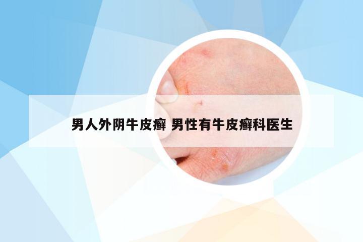 男人外阴牛皮癣 男性有牛皮癣科医生