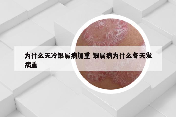 为什么天冷银屑病加重 银屑病为什么冬天发病重