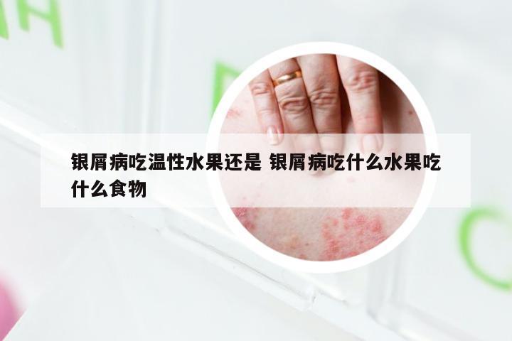 银屑病吃温性水果还是 银屑病吃什么水果吃什么食物